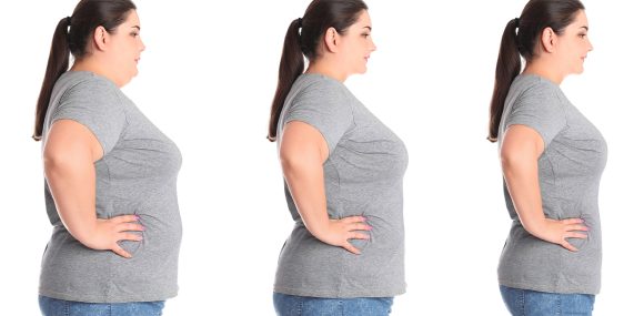 Collage-with-photos-of-overweight-woman-before-and-after-weight-loss